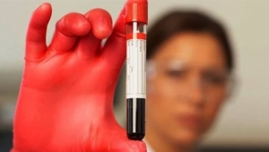 HUZURSUZLUK, TERLEME, CİLTTE SOLUKLUK VARSA… 