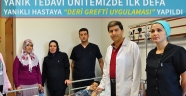 YANIK TEDAVİSİNDE İLK YAŞANDI..